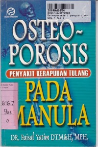 Image of Osteoporosis ( Penyakit Kerapuhan Tulang ) Pada Manula
