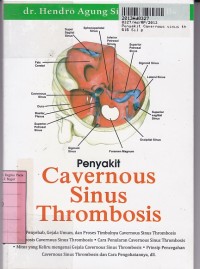 Image of Penyakit: Covernous Sinus Thrombosis