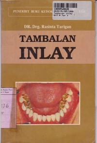 Image of Tambalan Inlay