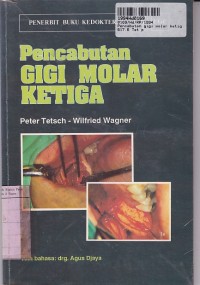 Image of Pencabutan Gigi Molar Ketiga= Operative Extraction of Wisdom Teeth